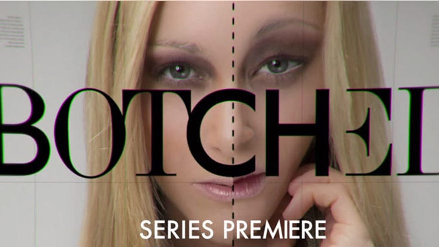Botched reality show 660.jpg